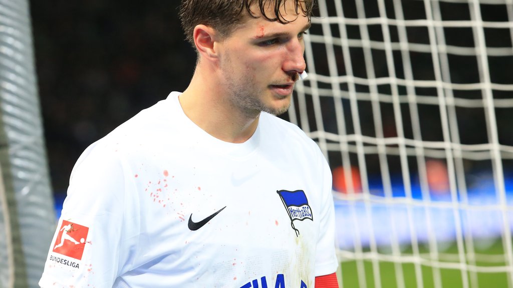 Blutige Nase: Niklas Stark musste mit Verdacht auf Nasenbeinbruch ausgewechselt werden.